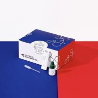 КАРДИО-ПАНЕЛЬ (МИОГЛОБИН, КРЕАТИНКИНАЗА-МВ, ТРОПОНИН I)